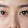 Nối mi có làm khô mắt không?
