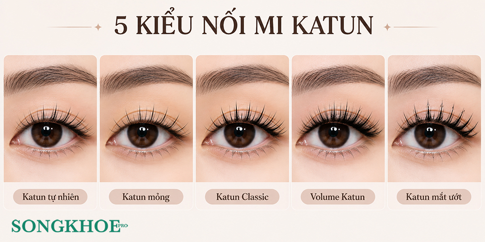 các kiểu mi